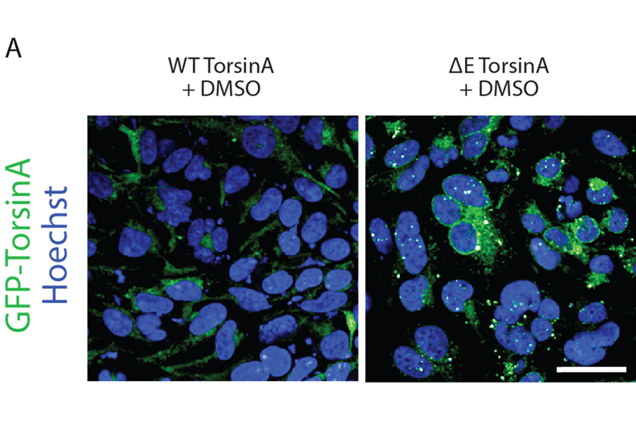 Cells used to test drugs’ potential effectiveness.