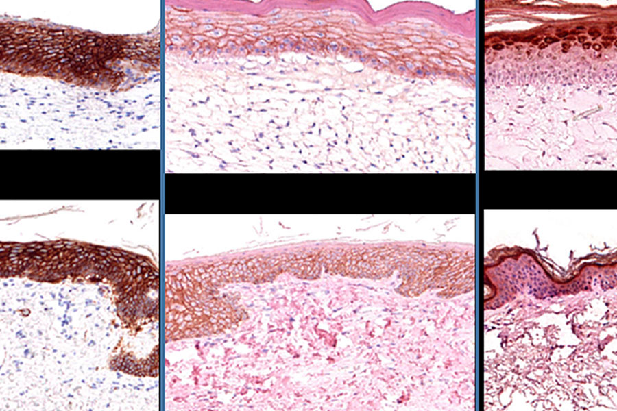 Histology is the gold standard to determine the architecture of tissues. These panels showing histological images of 3-D Bioprinted skin (top row) and native skin (bottom row) staining for different markers relevant to skin cells and extracellular matrix composition.