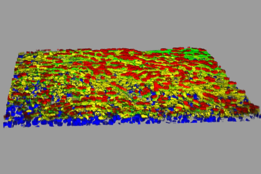 This 3-D model of lung small airway cells is stained with different colored markers that show certain cell types. The yellow represents the receptor protein involved in SARS-CoV-2 infection. (Yen-Ting Tung, Ph.D., and Olive Jung)