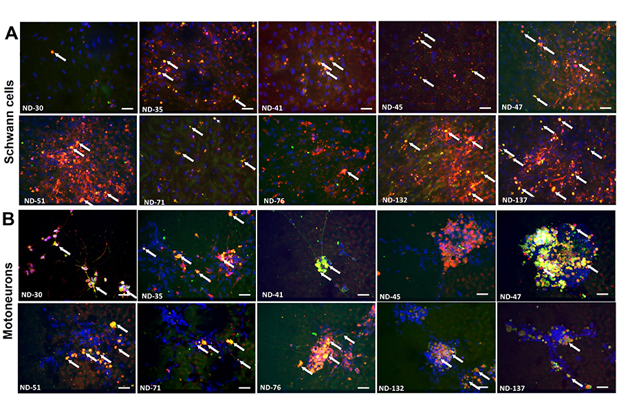 Antibodies attach to Schwann cells and motoneurons.