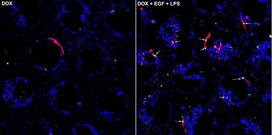 The above images show human liver cells (blue) and breast cancer cells (red) in the LiverChip model.