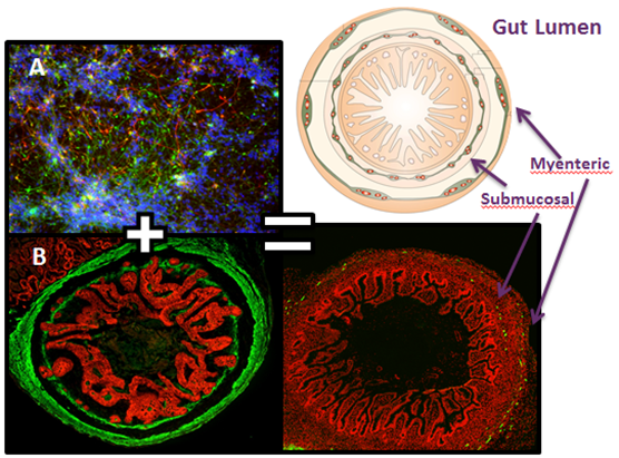 Photo A above shows nerve cells that were incorporated into human gut tissue grown from iPSCs (Photo B). When incorporated onto a chip, the result will be a gut on a chip, complete with nerves and a cross-sectional structure resembling that of human intestines, as shown on the bottom right.