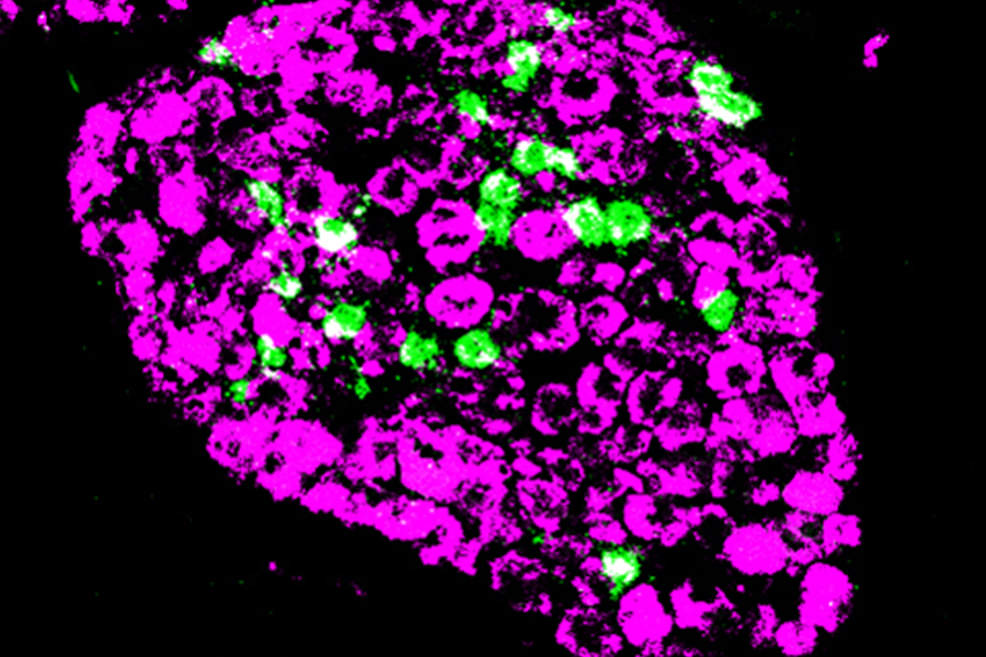 Nerves involved in detecting an itch and sensing pain.