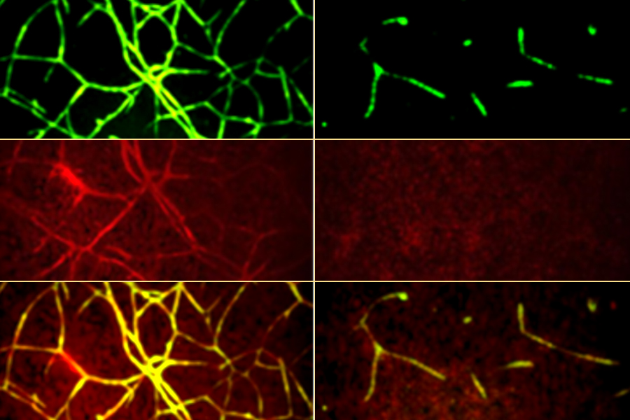 Images of blood vessel “tubes” in the high-throughput screening assay for angiogenesis